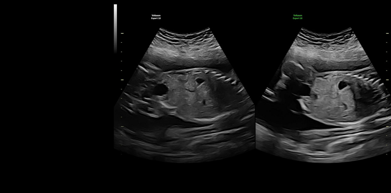 voluson-expert-18-difficult-exams-ci-en