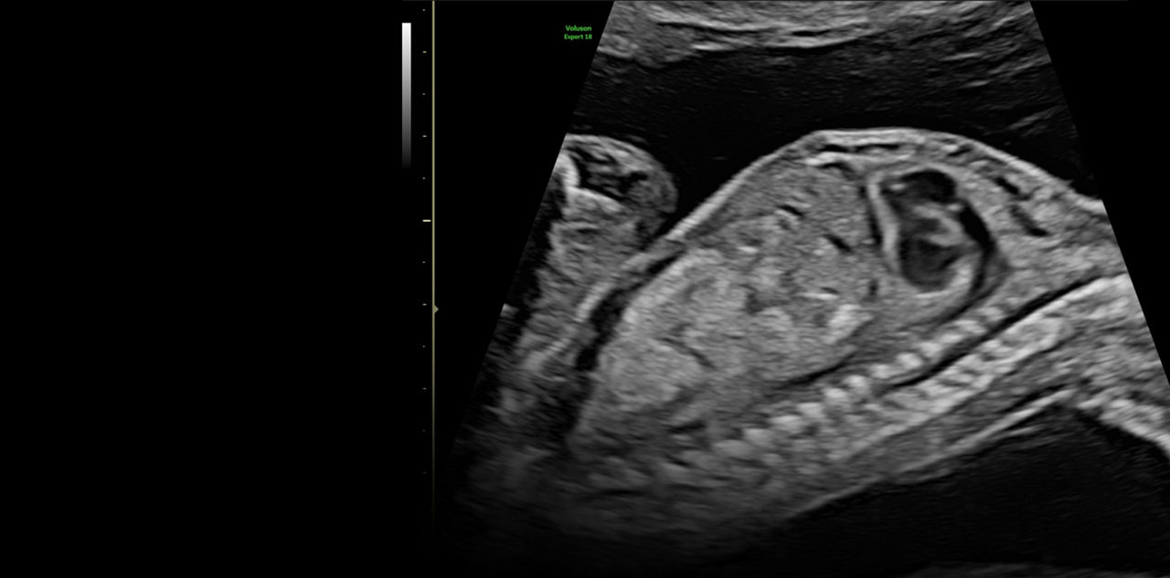 voluson-expert-18-lyric-architecture-ci-en