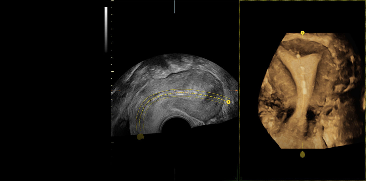 Voluson-Expert-18-Volume-Imaging