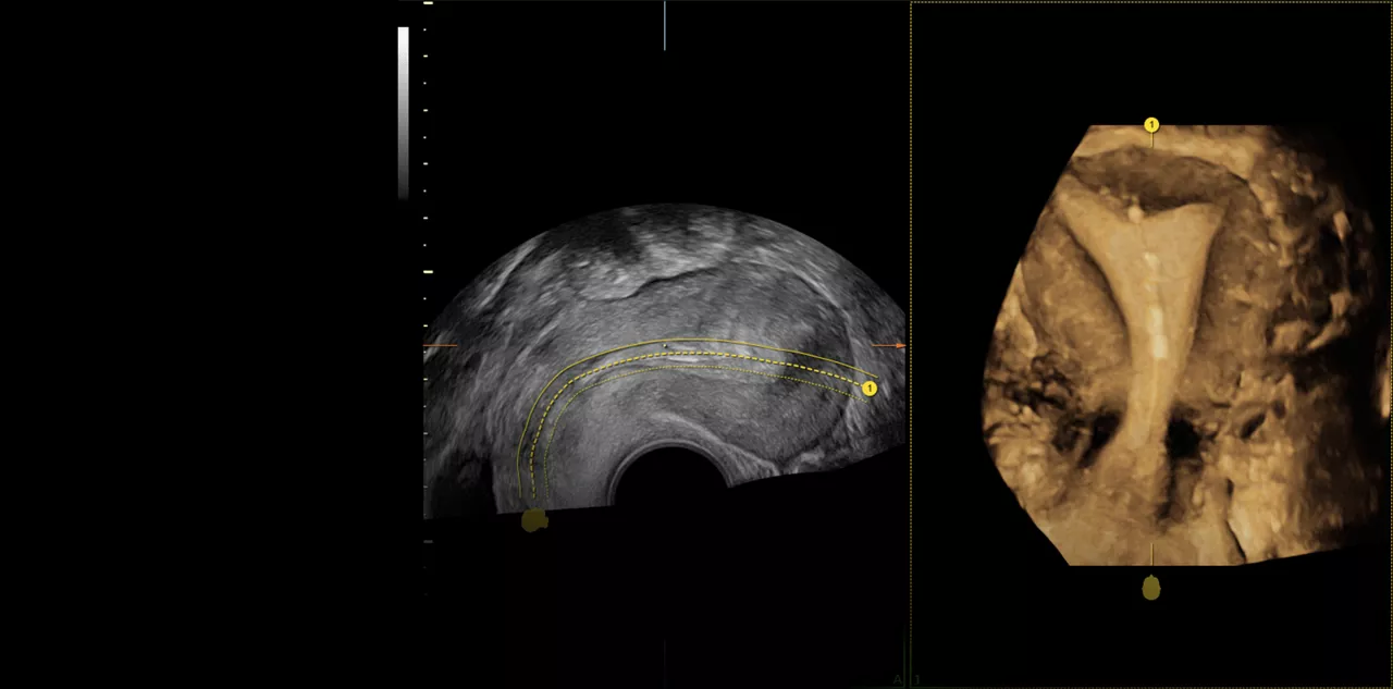 Voluson-Expert-18-Volume-Imaging
