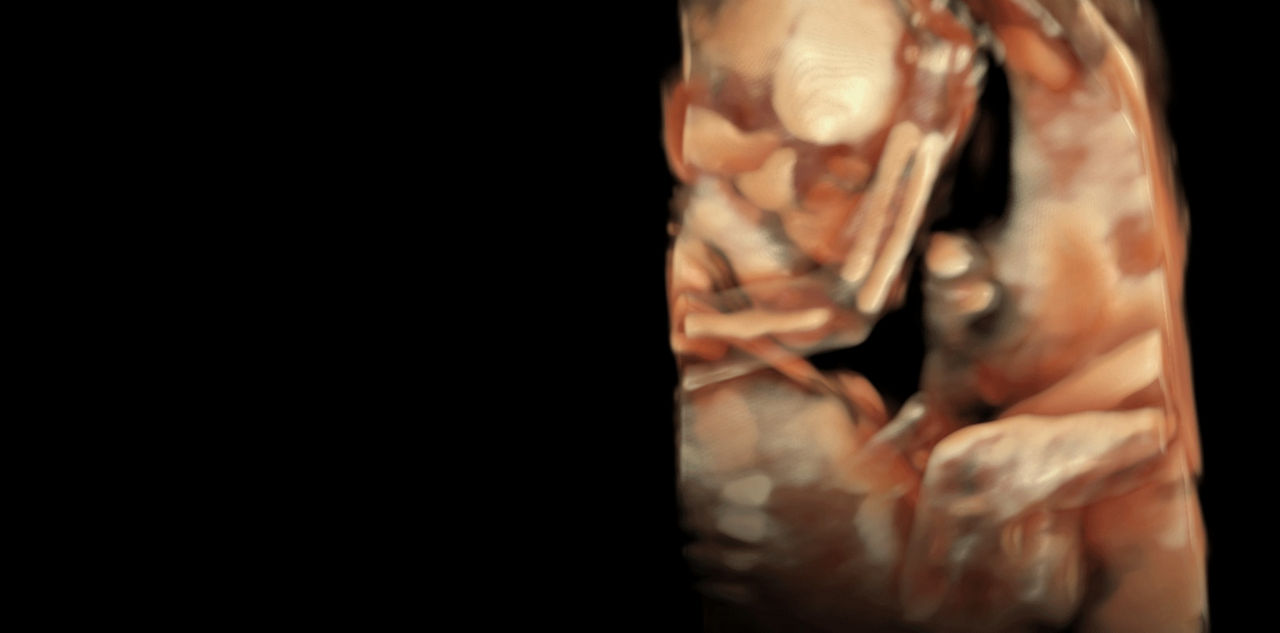 voluson-expert-20-imaging-ci-en