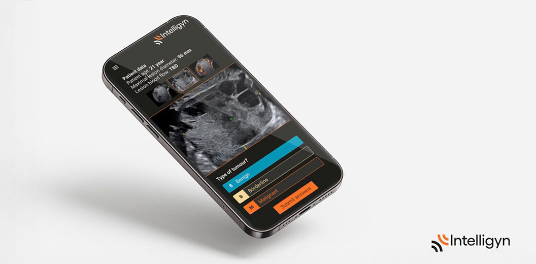 voluson-intelligyn-asset-st-en