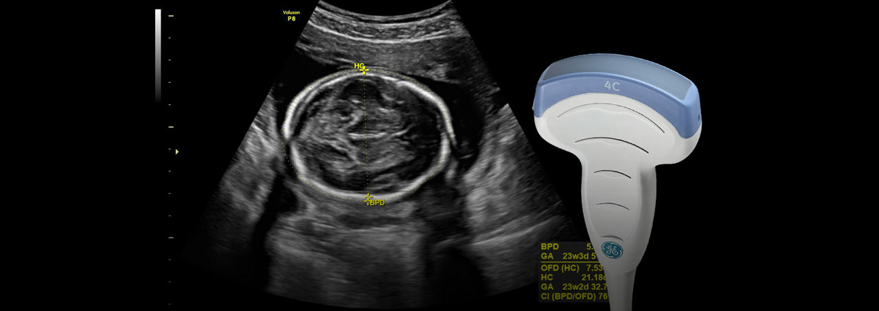 voluson-p8-4c-rs-probe-ci-en