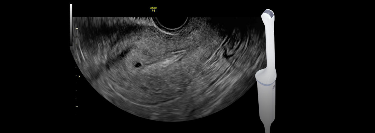 voluson-p8-ic9-rs-probe-ci-en
