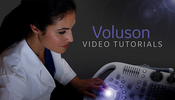 voluson-performance-p8-s-curve-module-image4