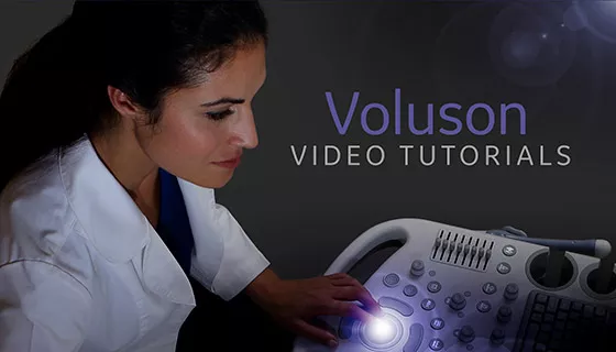 voluson-performance-p8-s-curve-module-image4