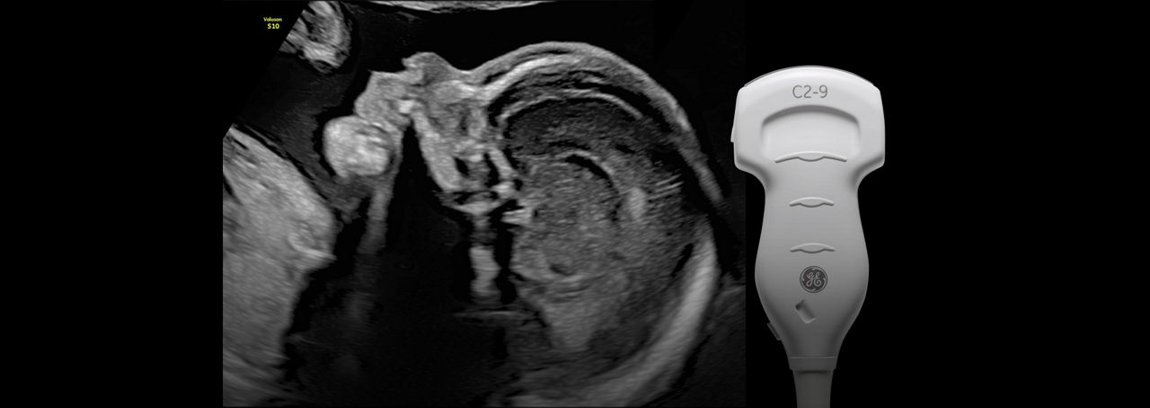 voluson-s10-expert-c2-9-rs-ci-en