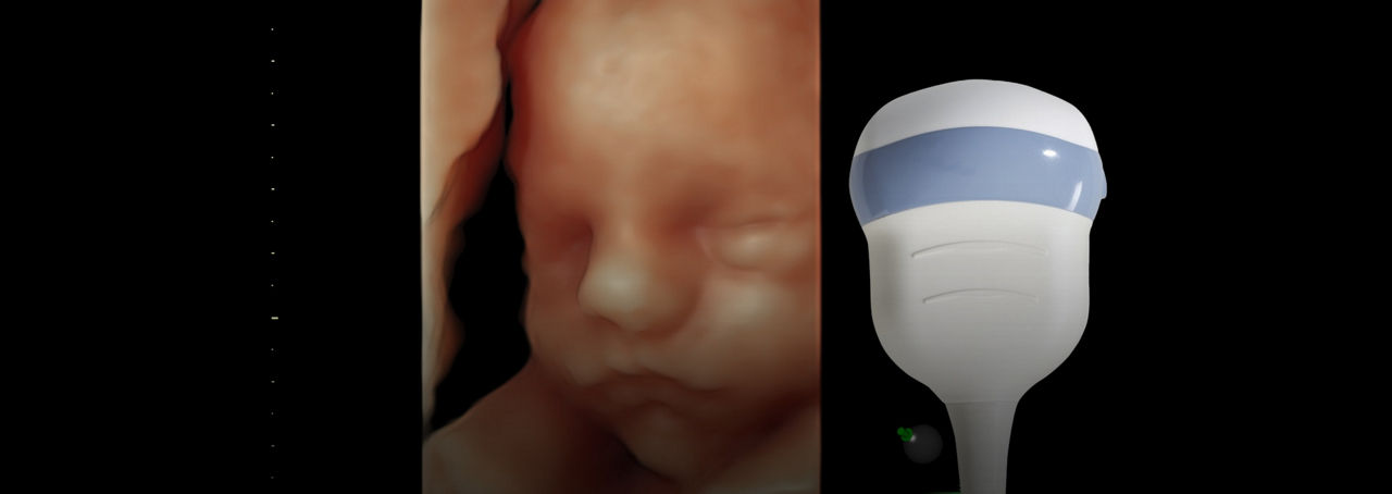 voluson-s10-expert-rab6-rs-ci-en