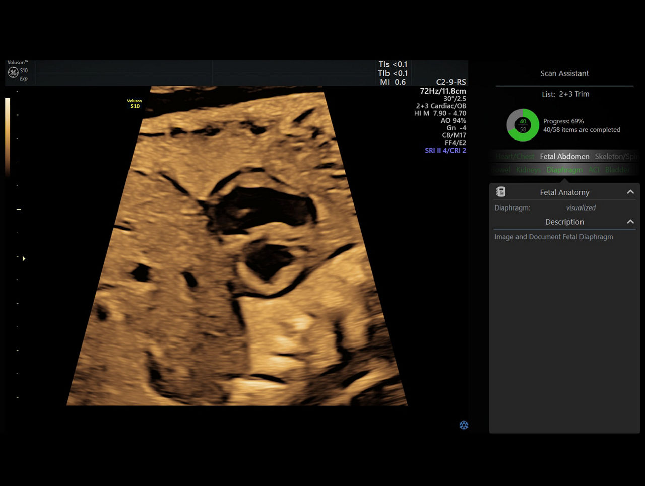 voluson-s10-expert-scan-assistant-ci-en