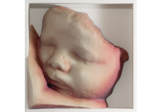 voluson-s10-ultrasound-3d-printing-st-en
