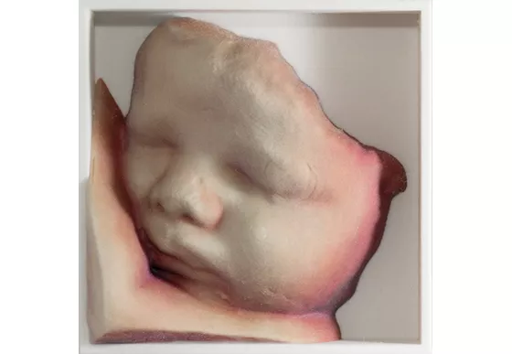 voluson-s10-ultrasound-3d-printing-st-en