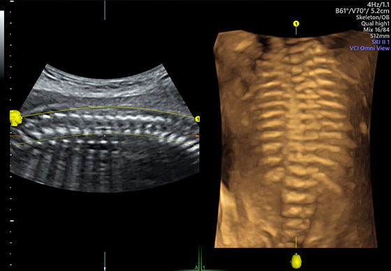 voluson-s10-ultrasound-omniview-ci-en