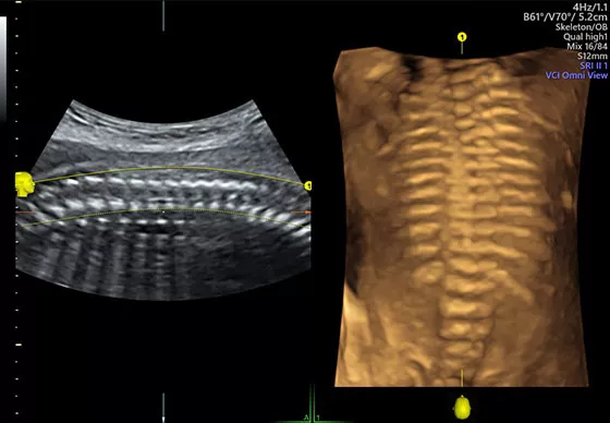 voluson-s10-ultrasound-omniview-ci-en