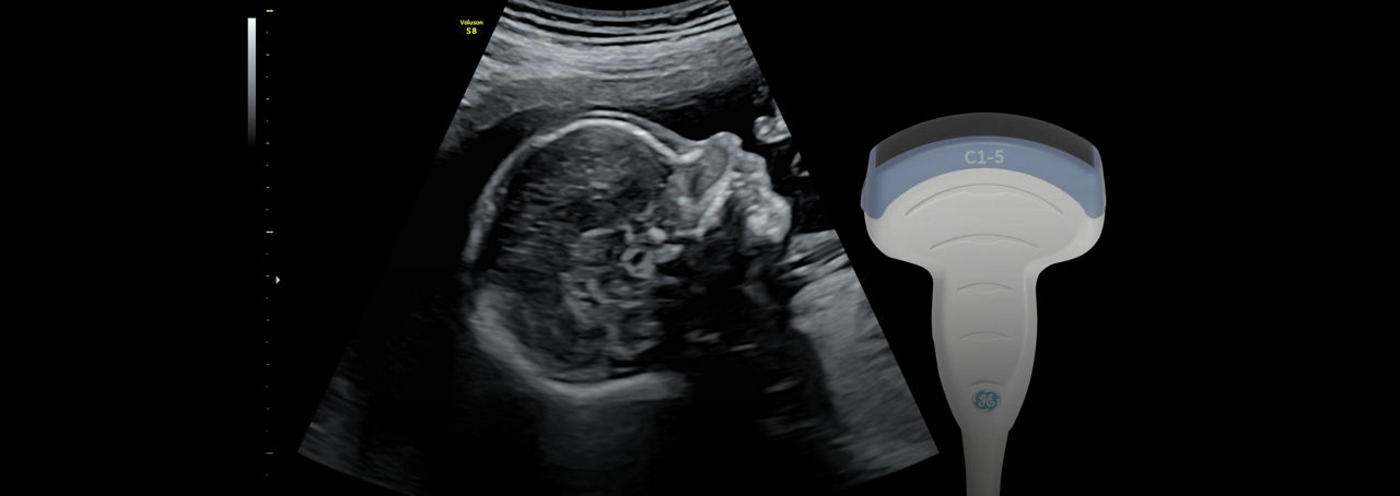 voluson-s8-probe-c1-5-rs-ci-en