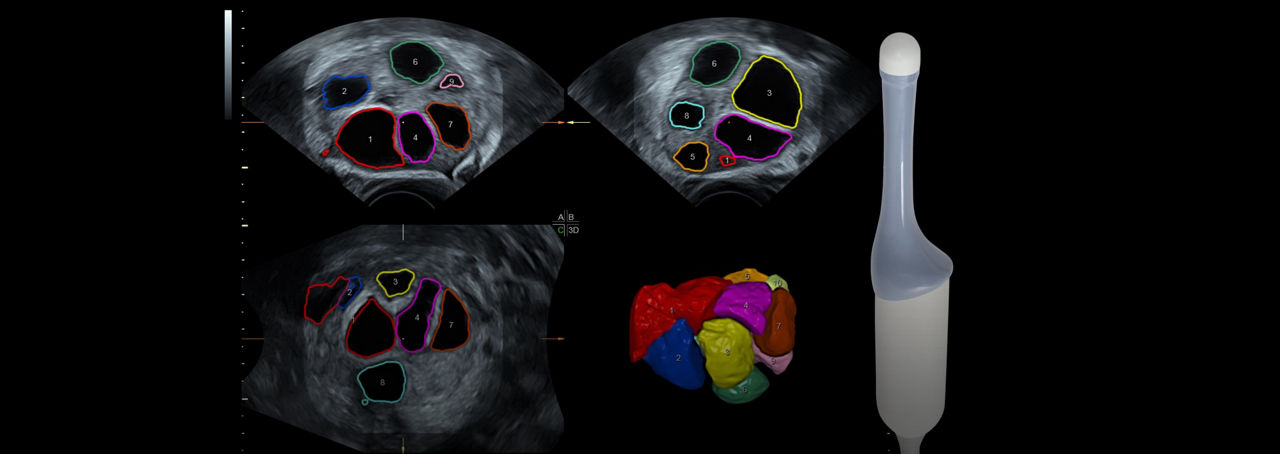 voluson-s8-probe-ric5-9-rsci-en