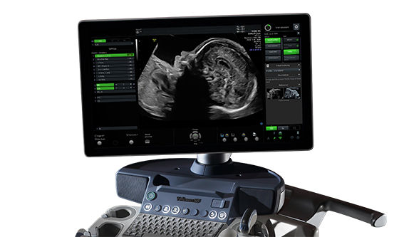 voluson-s8-signature-series-ge-s-curve-scan-assistant