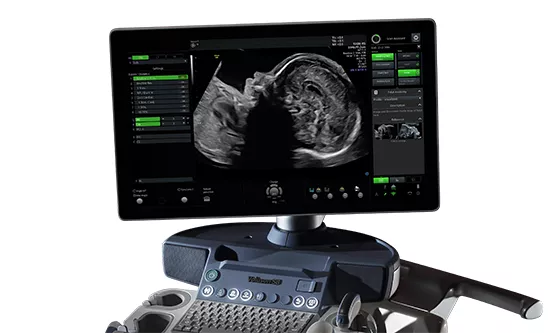 voluson-s8-signature-series-ge-s-curve-scan-assistant