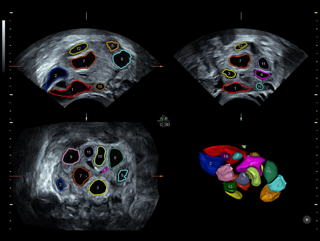 voluson-s8-technology-sonoavc-ci-en