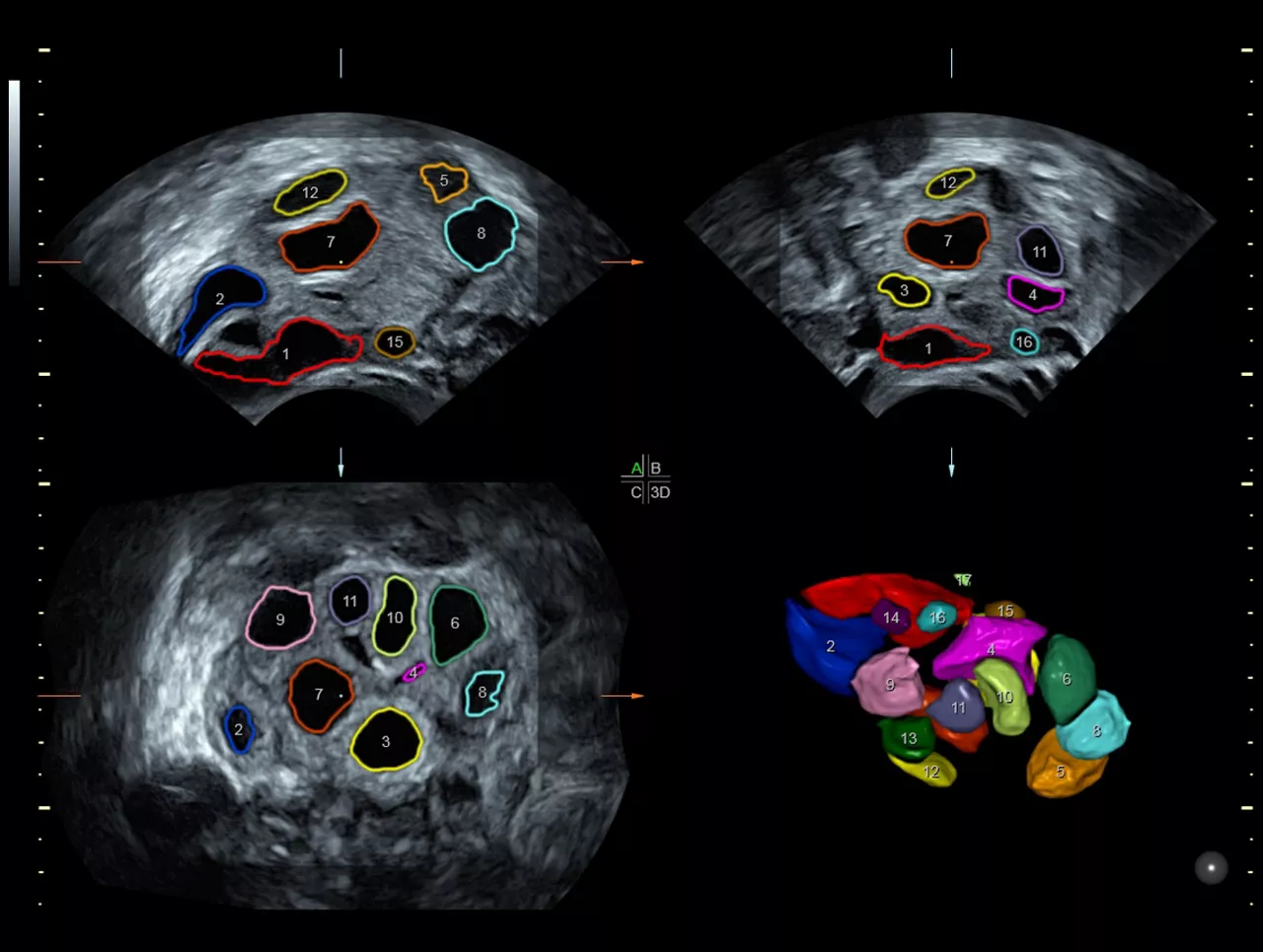 voluson-s8-technology-sonoavc-ci-en