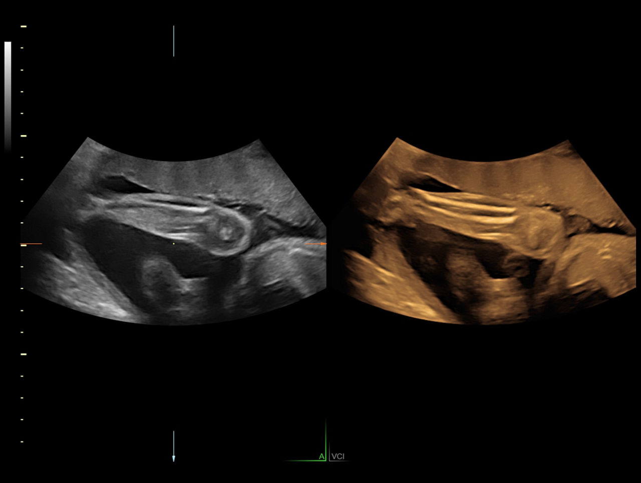 voluson-s8-technology-vic-ci-en