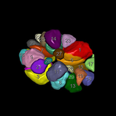 voluson-segment-assisted-reproductive