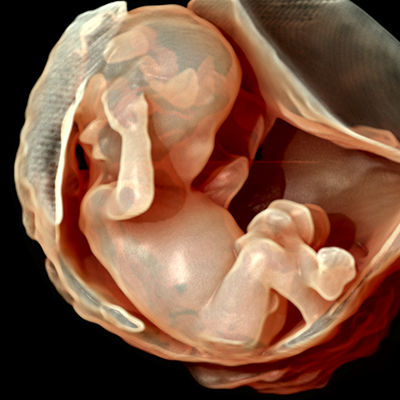 voluson-segment-maternal-fetal-medicine