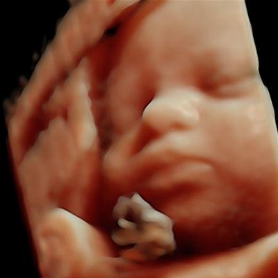 voluson-segment-obstetrics