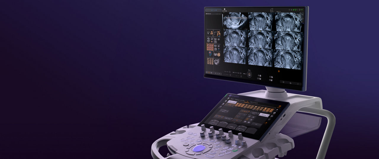 voluson-signature-18