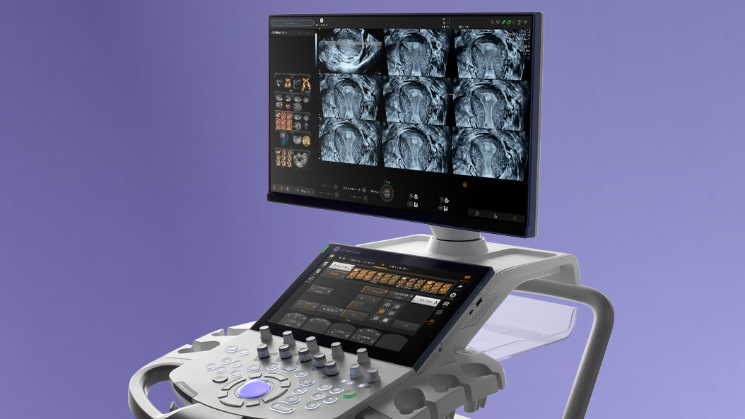 voluson-signature-18--1