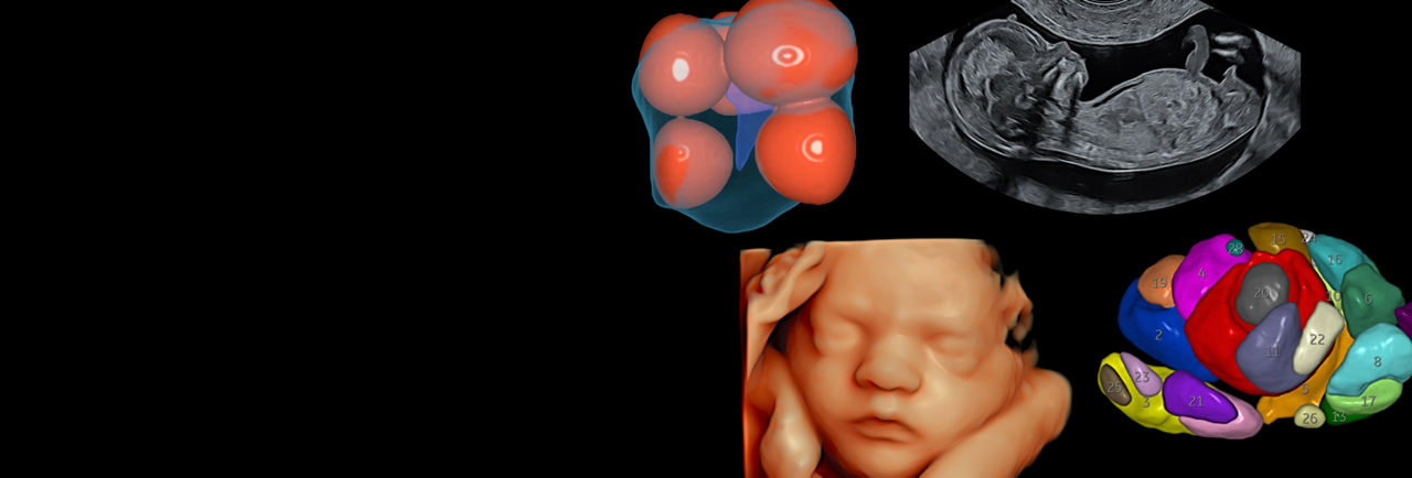 Voluson-Solution-Store