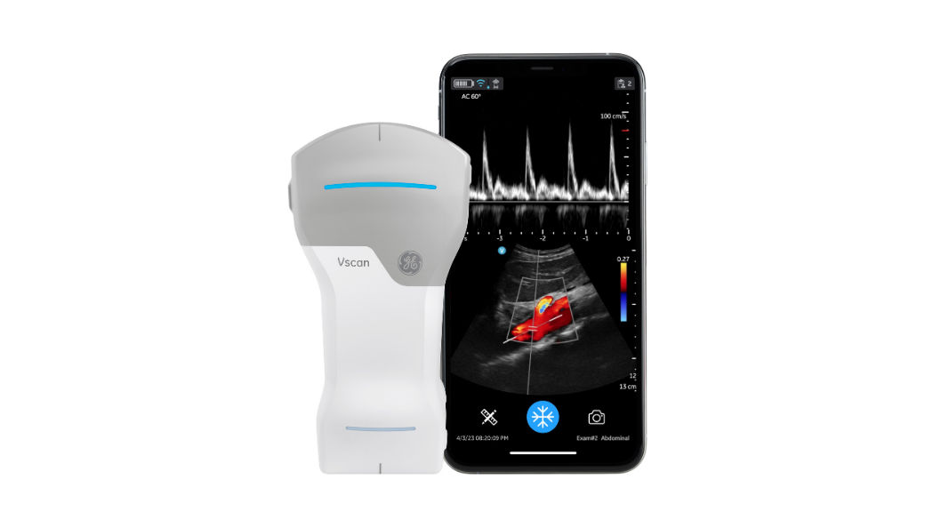 Vscan Air CL Handheld Ultrasound