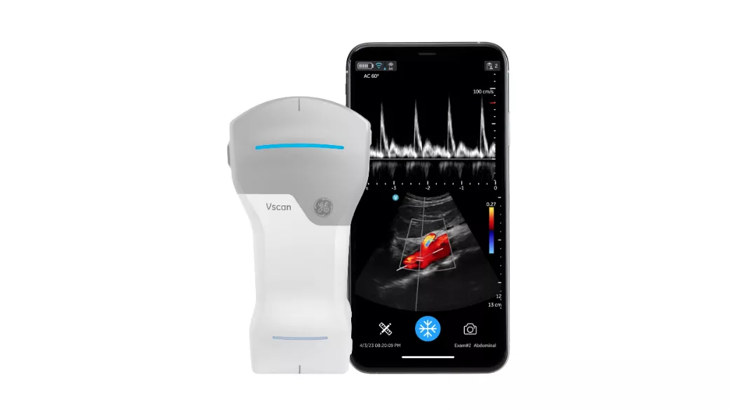 Vscan Air CL Handheld Ultrasound