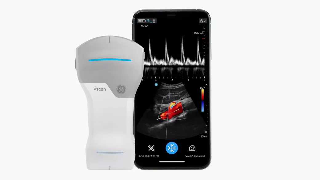 Vscan Handheld Ultrasound | GE HealthCare (Japan)