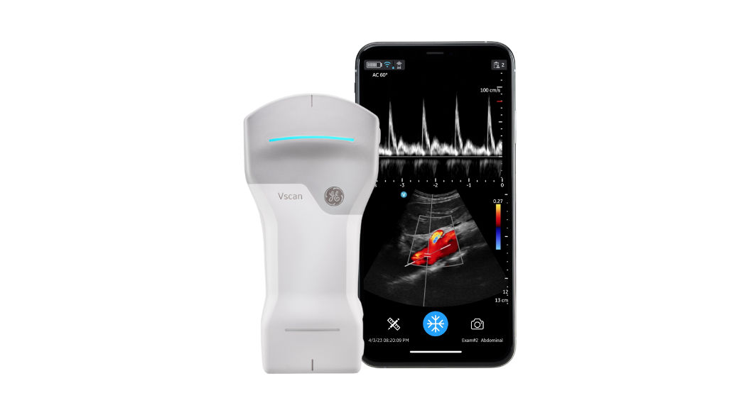 Vscan Air™