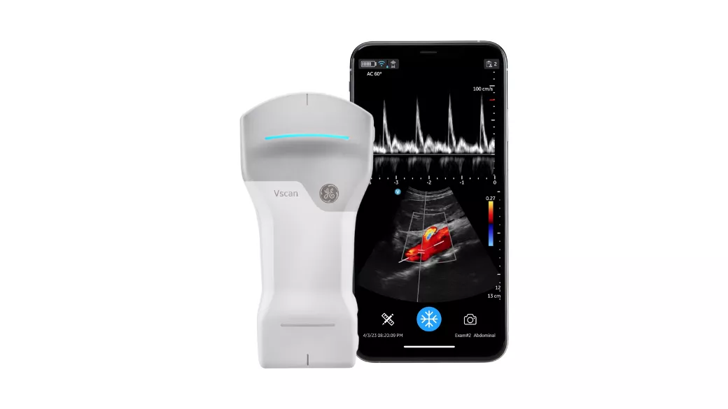 Vscan Air CL Handheld Ultrasound