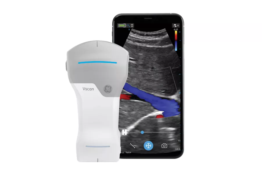 vscan-air-handheld-ultrasound