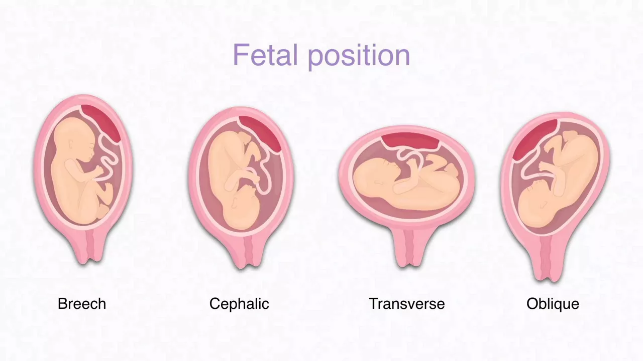 vscan-air-how-to-assess-the-fetal-position
