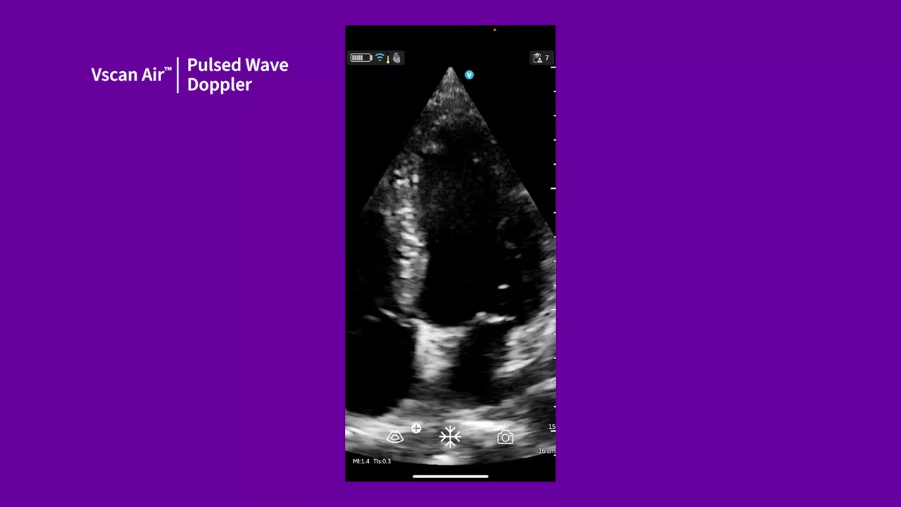 vscan-air-tutorials-pulsed-wave-doppler