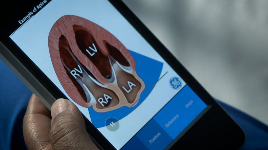 vscan-extend-Bladder-Scan-Coach-FCU