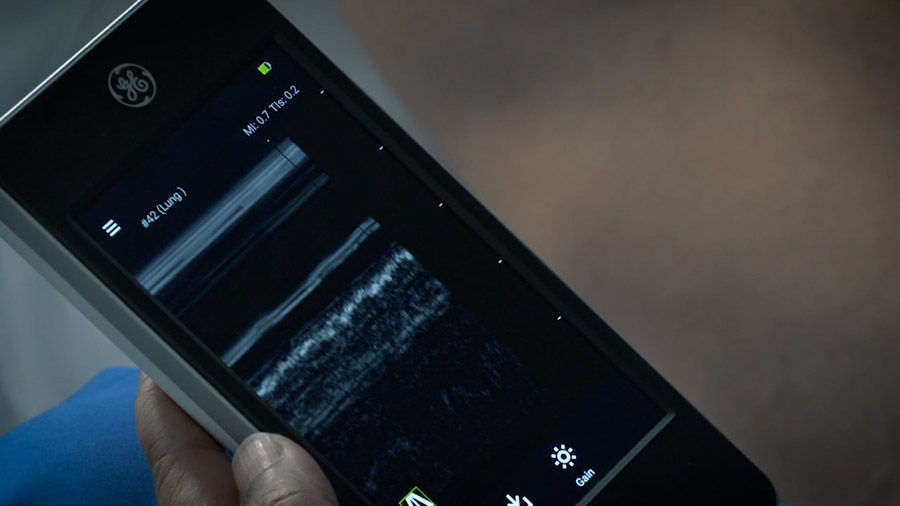 vscan-extend-Lung-M-Mode