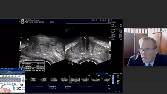 Vscan-extend-remote-training