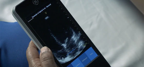 Vscan Extend Scan Coach FATE