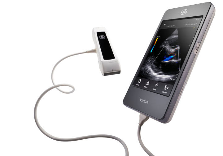 Vscan Extend Handheld Ultrasound