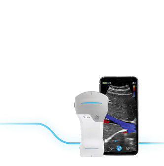 Vscan-Handle