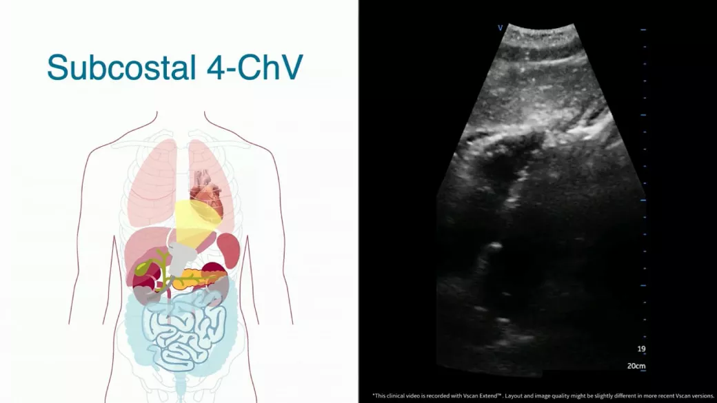 vscan-which-views-of-the-chest-are-te-JB27779XX-en