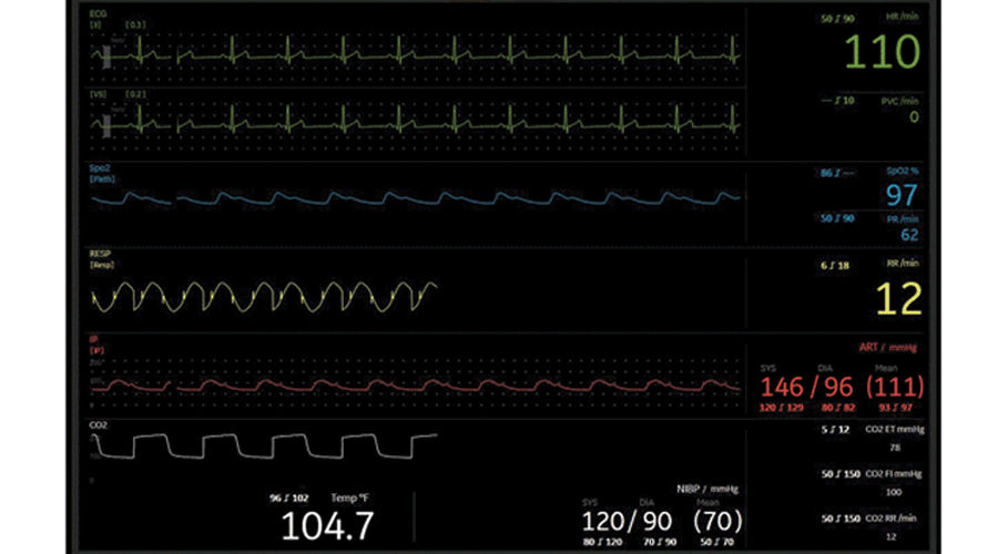 waveform1