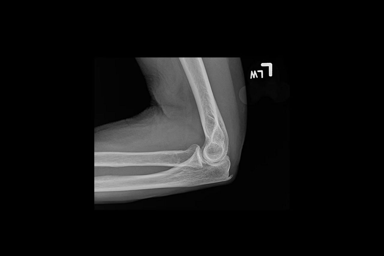 web-helix-3-noise-ci-en