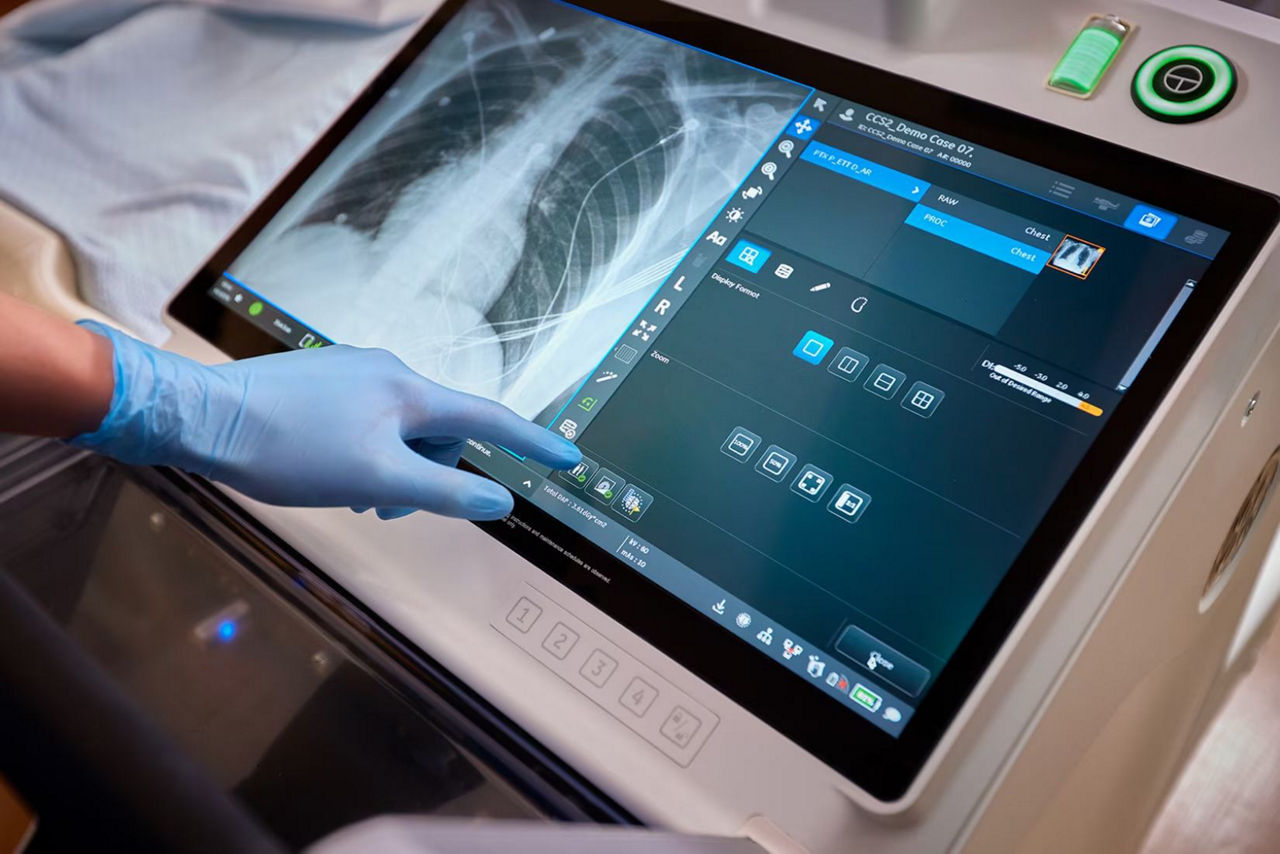 web-helix-4-flexibility-ci-en