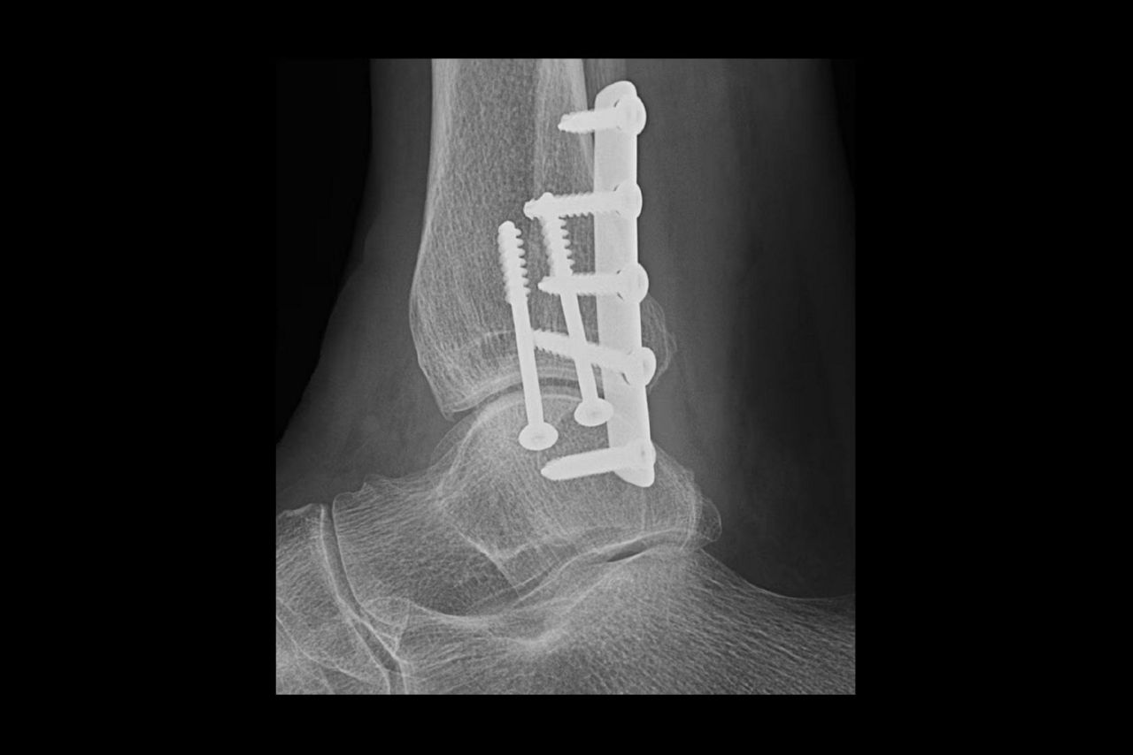 web-helix-feature-ci-en