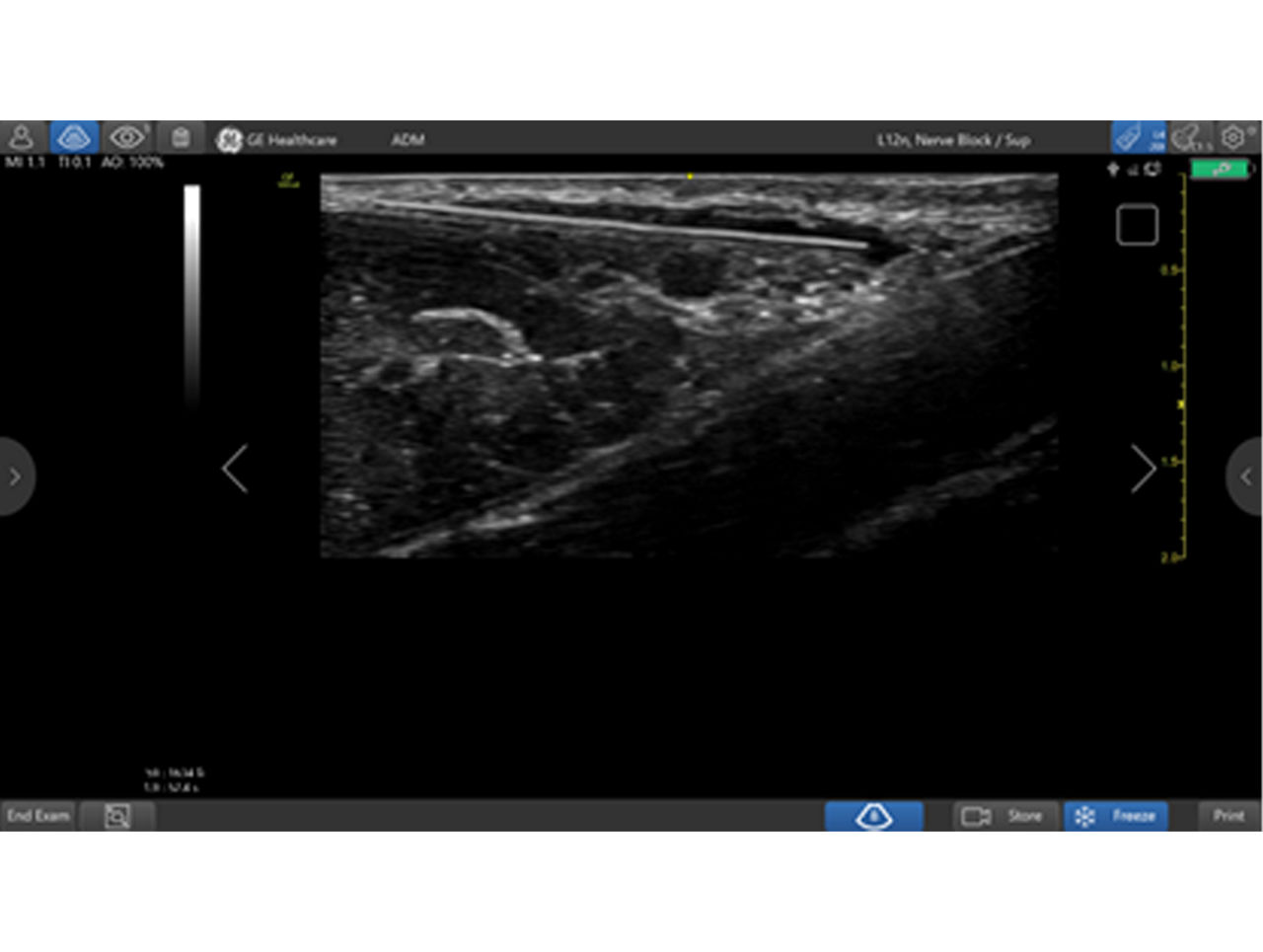WebsiteAnaesthesiaThird component the S curveDesktop21300x980
